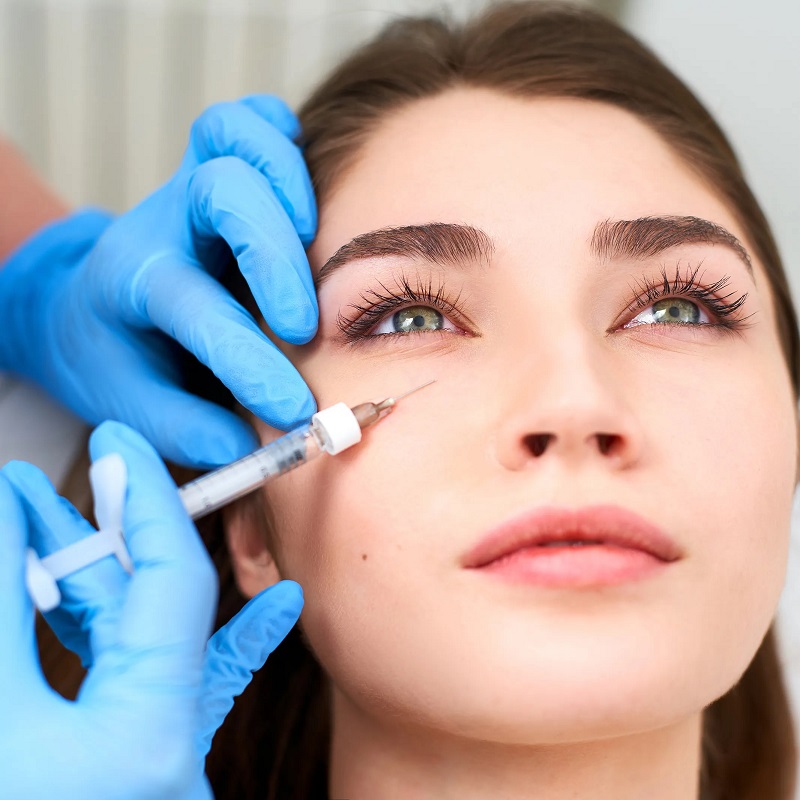 Điều trị nếp nhăn ở mắt bằng tiêm Filler, botox được nhiều người áp dụng.