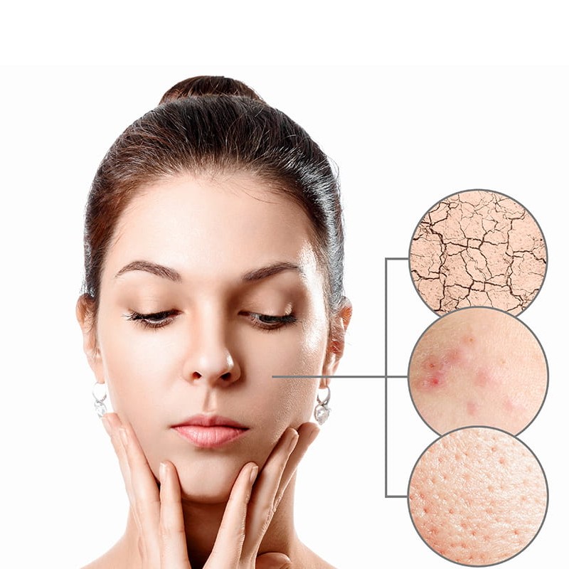 Serum phục hồi da cấp ẩm là giải pháp hiệu quả cho làn da bị tổn thương.